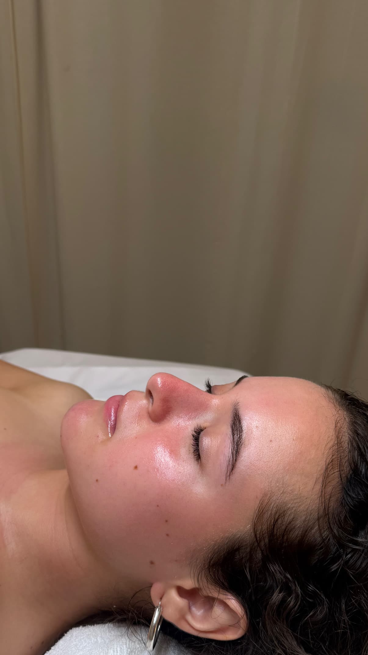 Rania, 21 after Custom Skin Treatment
